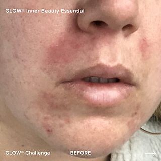 GLOW STARTER KIT
