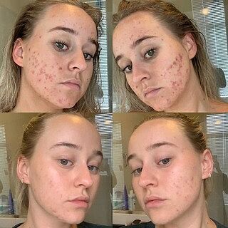 DAILY SUPERGREENS Inner Beauty Support