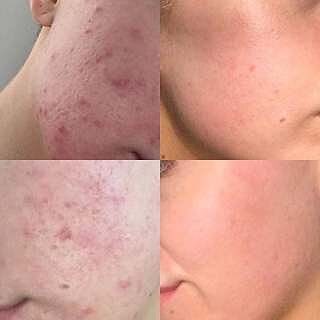 COLLAGEN BOOST™