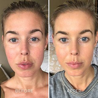 GLOW® Inner Beauty Essential