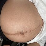 Bump Butter