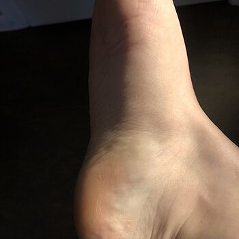 All Salve Came for a lip balm, stayed for a foot miracle