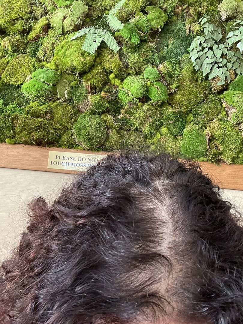 Hair Building Fiber Reviews (20,000+)