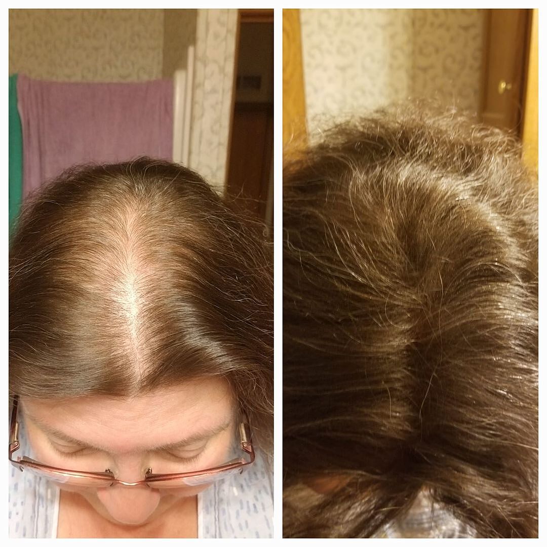 Best Hair Building Fiber