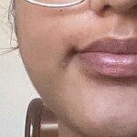 Image of Review by Ruchitha P. on  9 Sep 2024 number 1