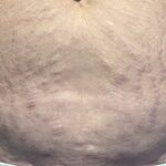 Review Image For review: 797762208