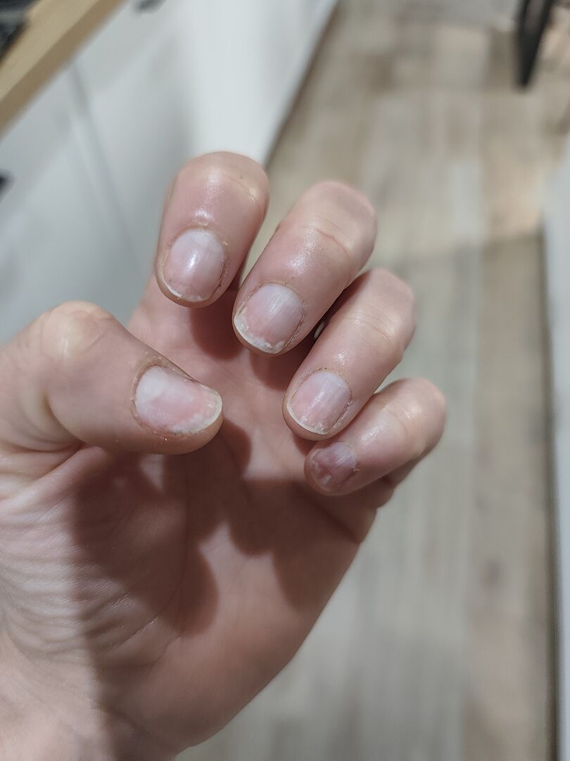 SmartGel™ NatraCure® Kit Esercizi Terapia Mani – Esercita E Rinforza Le Mani Comodamente A Casa
