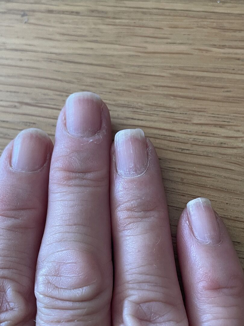 Gute Reparatur, braucht Geduld