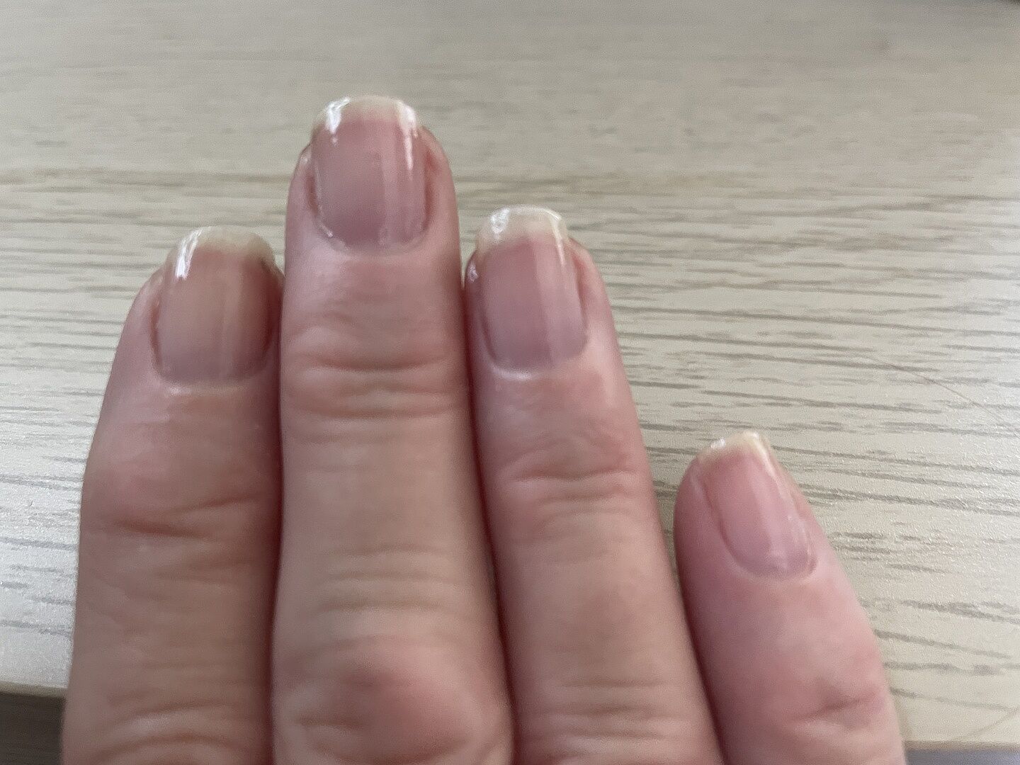 Rettet meine Naturnägel