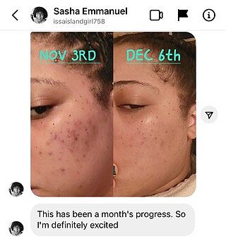 Clear Skin Cleansing Bar Daily Facial Cleanser Urban Skin Rx