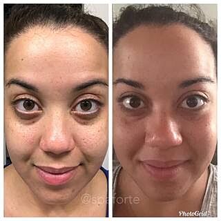 image skincare iluma intense lightening serum stores